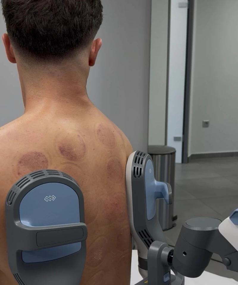 SIS THERAPY (SUPER INDUCTIVE SYSTEM)